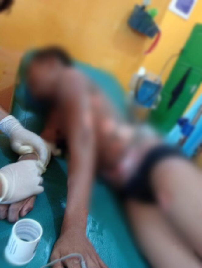 
 Seorang santri mengalami luka bakar serius usai bermain bersama tiga temannya di dekat sungai belakang asrama putra di Pondok Pesantren. Kini santri sedang dirawat di rumah sakit 