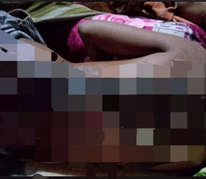 
 Tragis! Bocah Difabel 11 Tahun di Kolut Disiram Bensin hingga Terbakar 40 Persen, Dua Pelaku Ditangkap